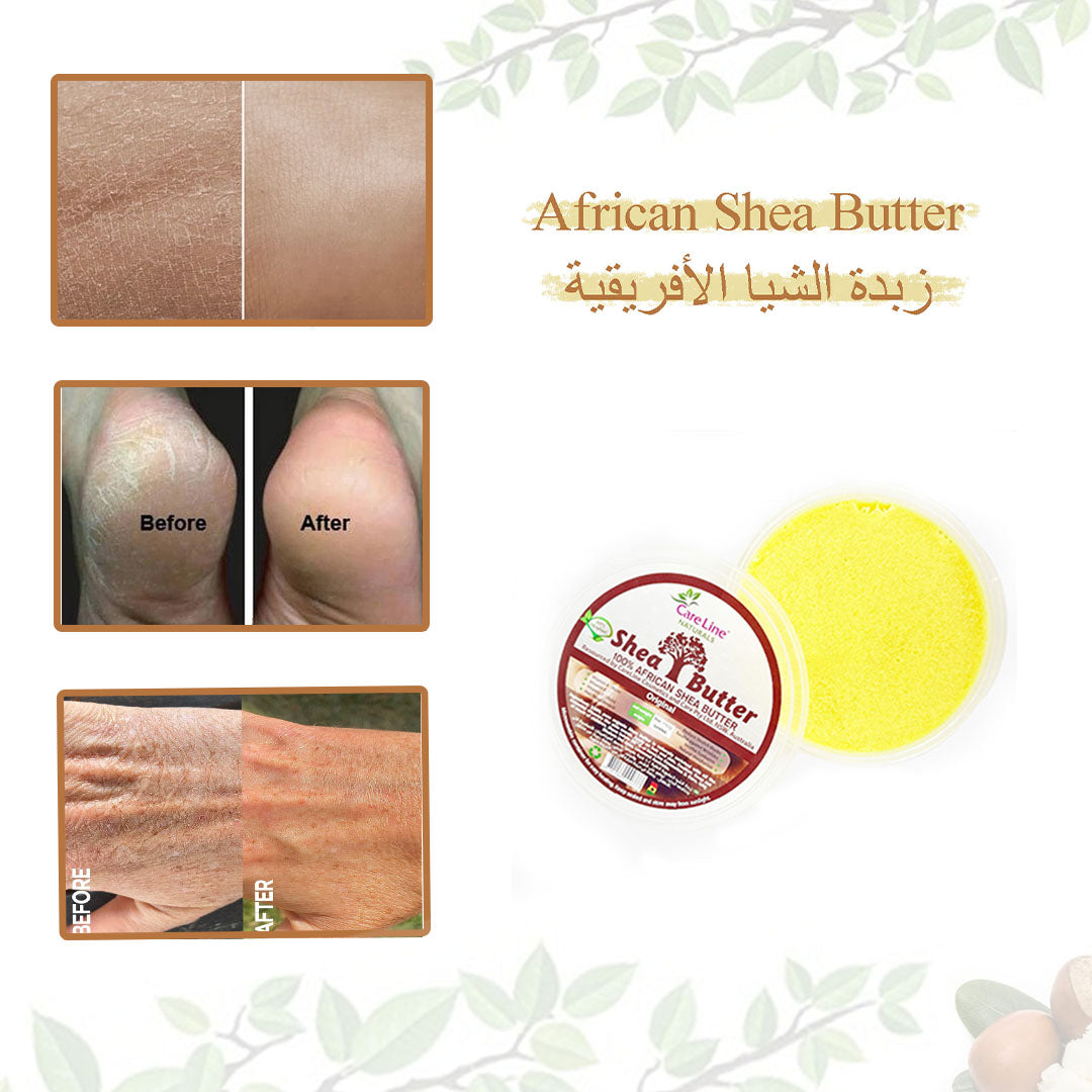 Stretch Mark Bundle Set of Four Product (Shea Butter, Moroccan Gloves, Moroccan Soap , Morrocon Nila) )